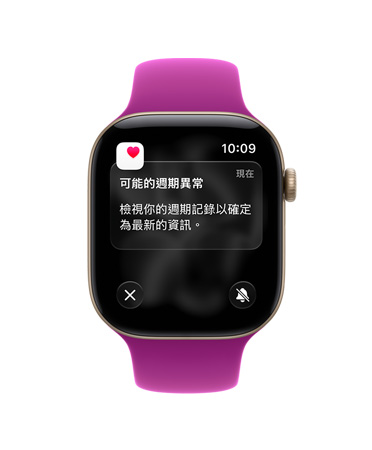 Apple Watch Series 12,展示淺金色鋁金屬錶殼,搭配洋紅色運動型錶帶,螢幕顯示可能的經期異常通知